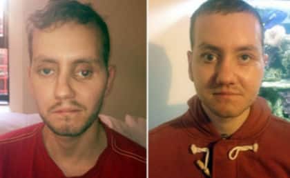 before and after
