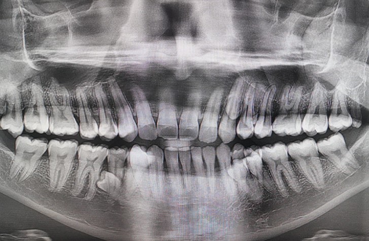 World record: Most teeth – Kiwi Kids News